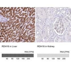 RDH16 Antibody, Novus Biologicals 0.1 mL | Buy Online | Novus Biologicals | Fisher Scientific